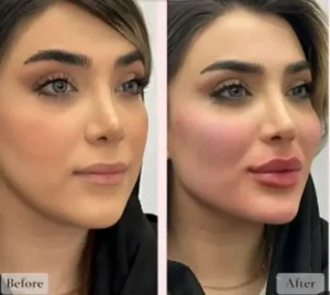 نیازمند پزشک مسلط به تزریقات زیبایی جهت کلینیک در نارمک تهران