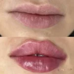 نیازمند پزشک عمومی خانم مسلط به تمام خدمات زیبایی جهت کلینیک در کرج