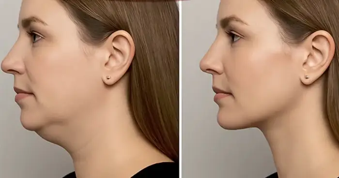 دعوت از متخصص جراحی عمومی جهت کلینیک زیبایی در کرج