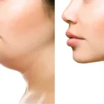 نیازمند متخصص جراحی عمومی جهت کلینیک زیبایی در تجریش تهران
