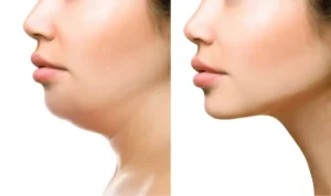 نیازمند متخصص جراحی عمومی جهت کلینیک زیبایی در تجریش تهران