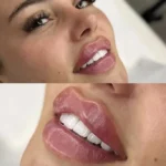 استخدام دستیار پزشک زیبایی جهت کلینیک در تبریز