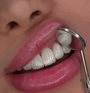 استخدام دستیار دندانپزشک و مسئول پذیرش جهت کلینیک در فردیس کرج
