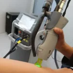استخدام اپراتور لیزر جهت کلینیک پوست و مو در کرمان